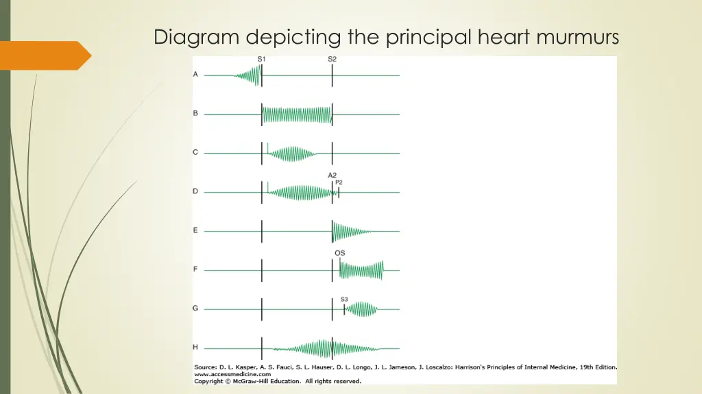 diagram depicting the principal heart murmurs
