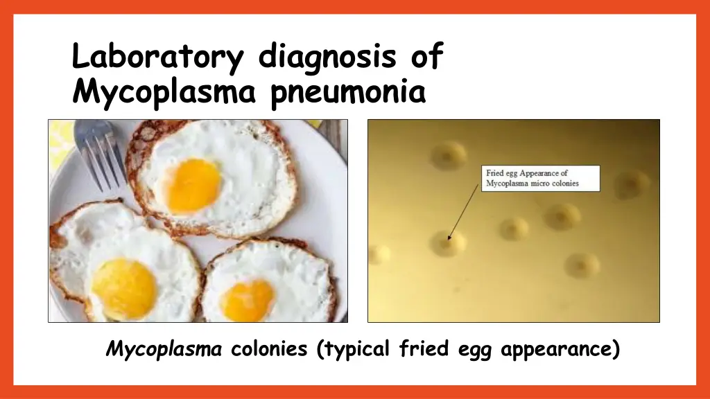 laboratory diagnosis of mycoplasma pneumonia 2