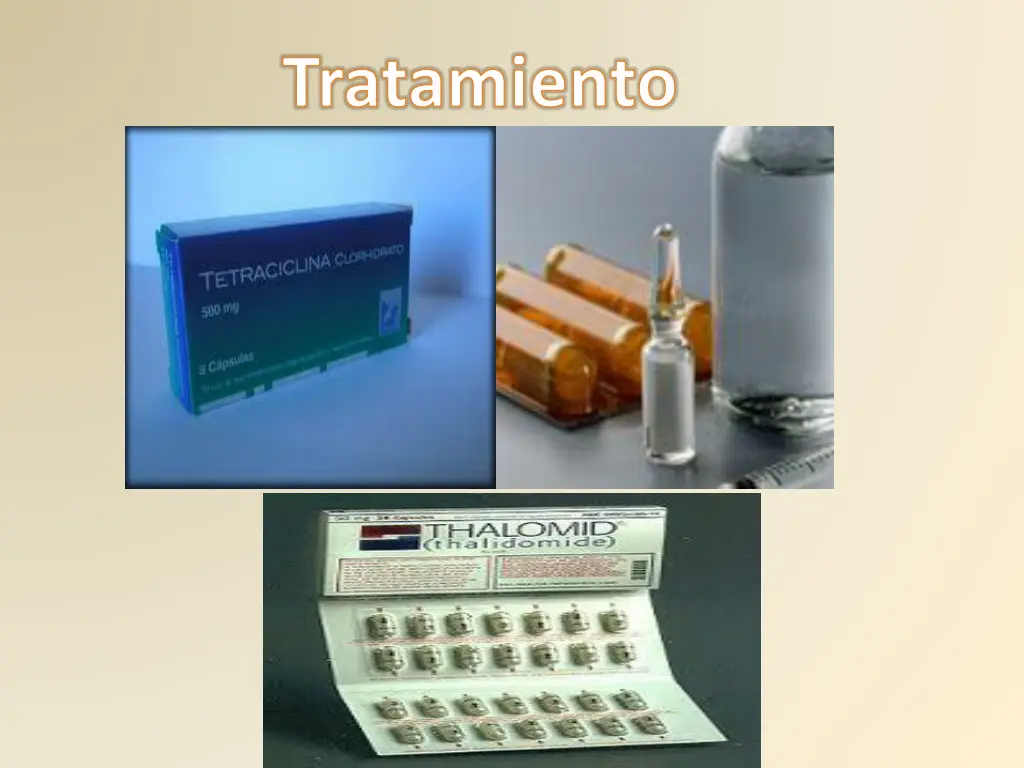tratamiento