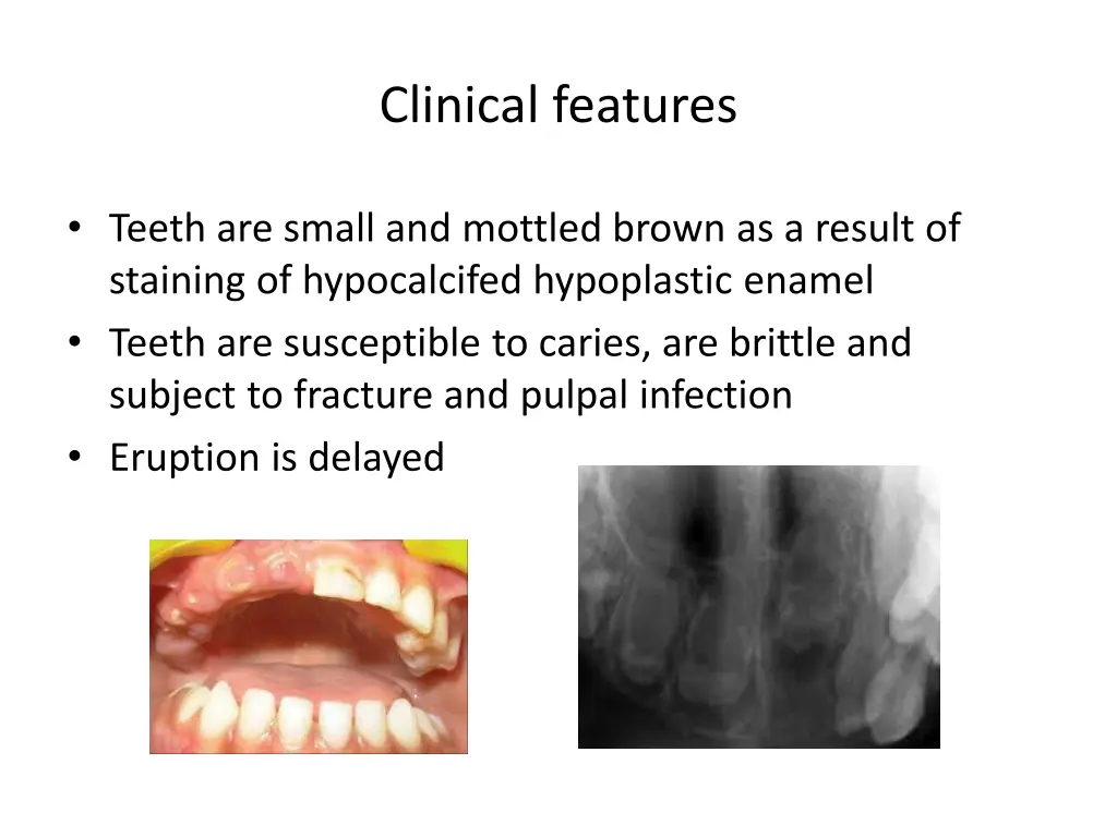 clinical features 1