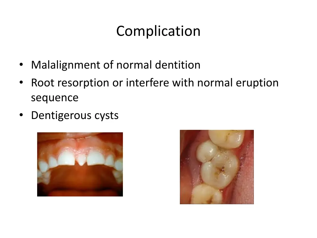 complication