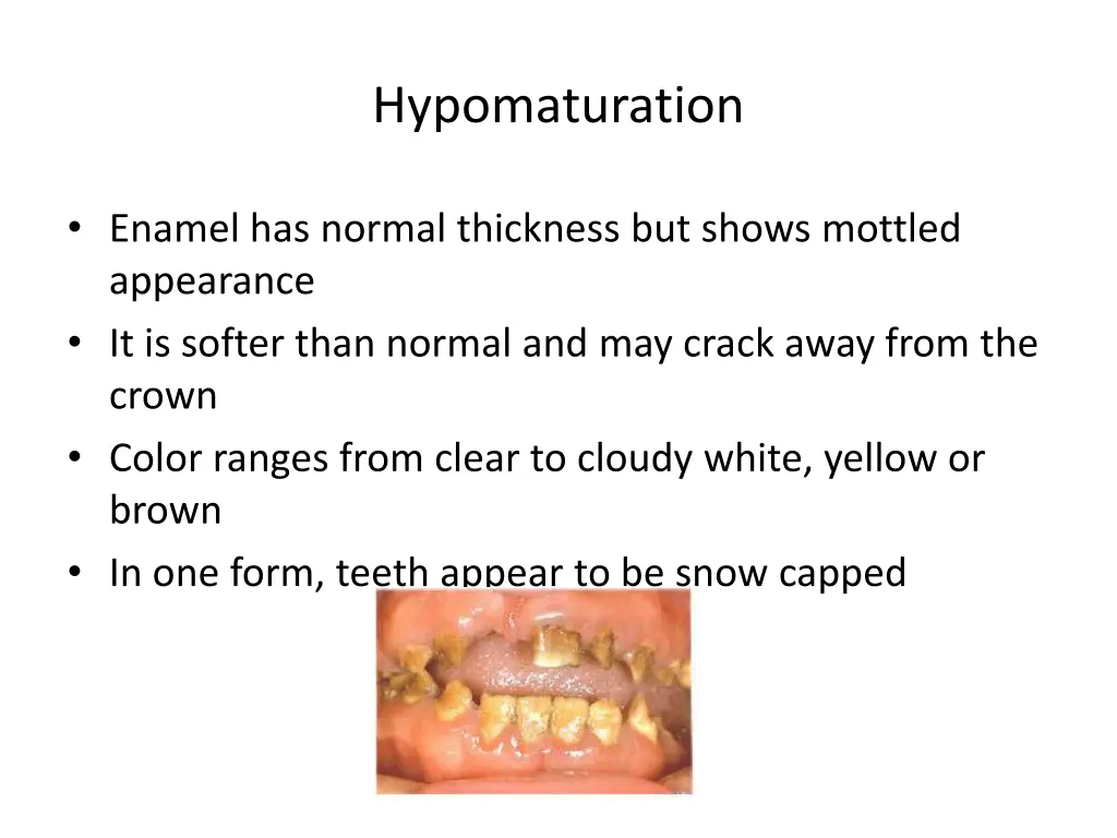 hypomaturation
