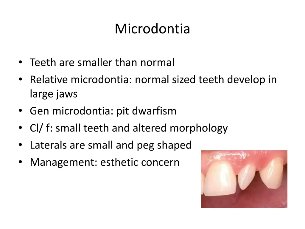 microdontia