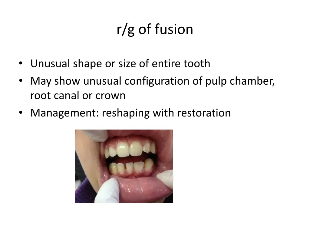 r g of fusion