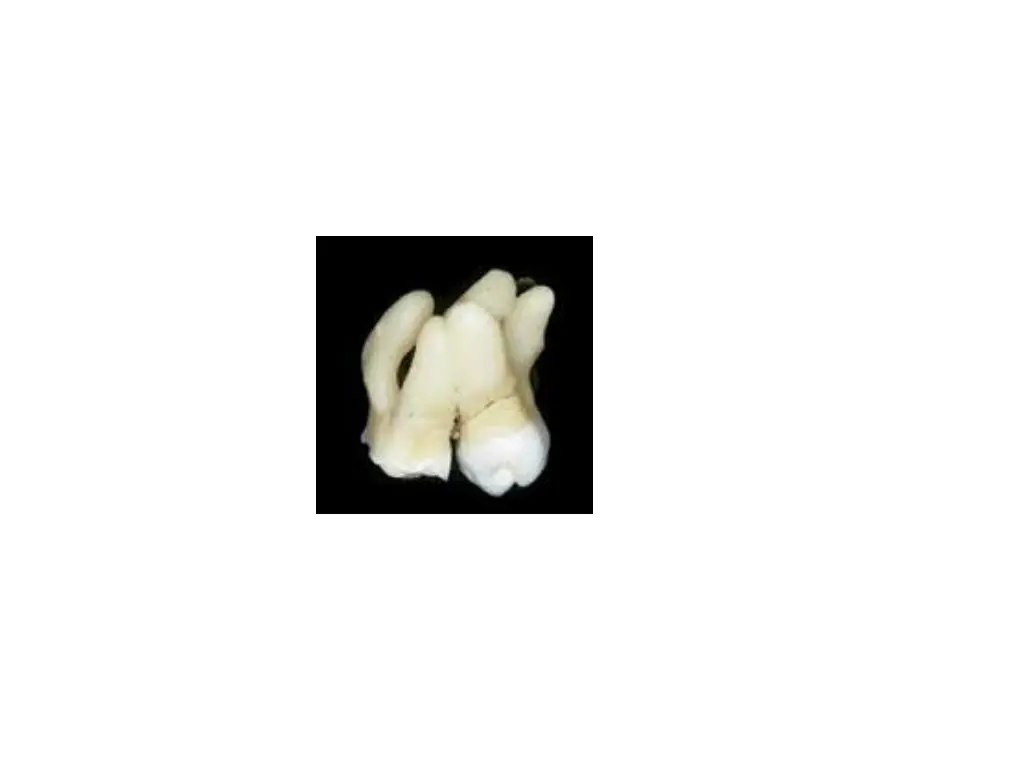 slide16
