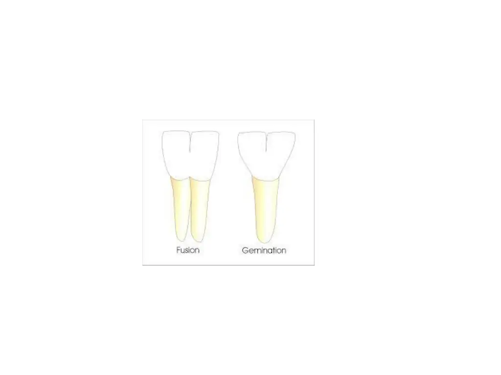 slide17