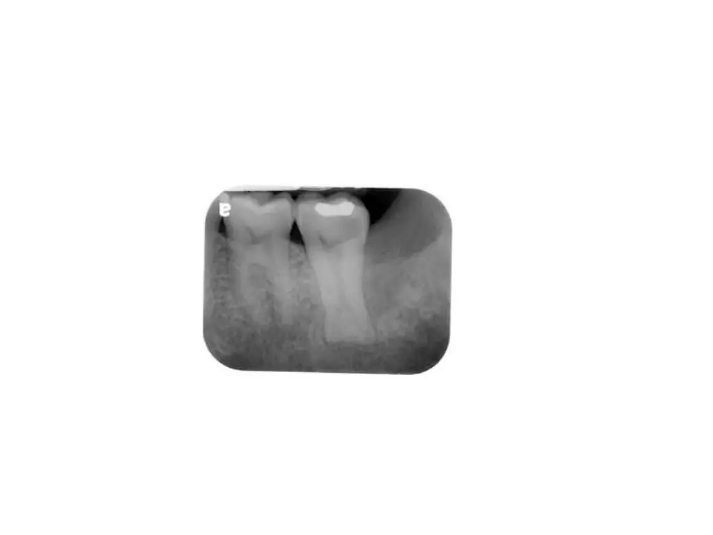 slide21