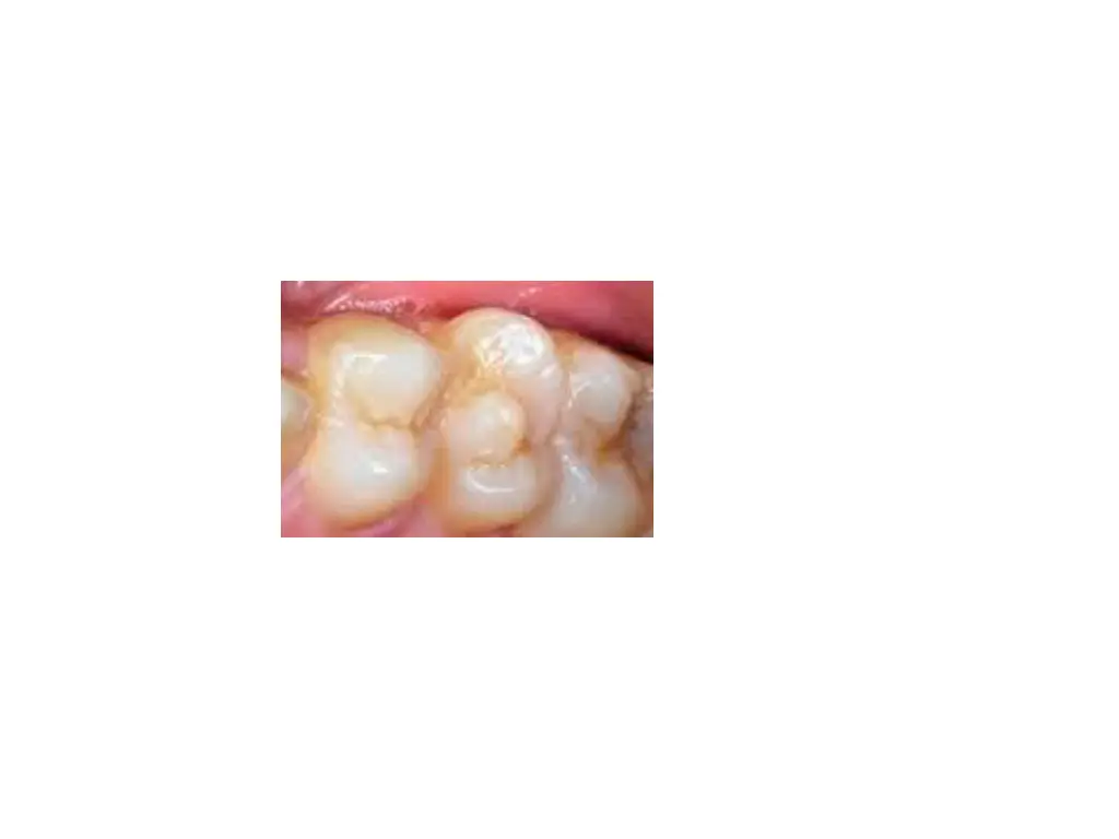 slide28