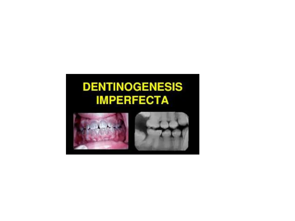 slide39