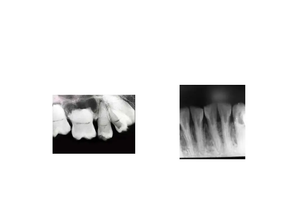 slide42