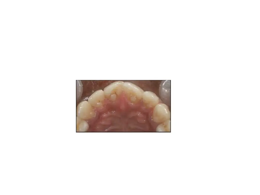 slide49