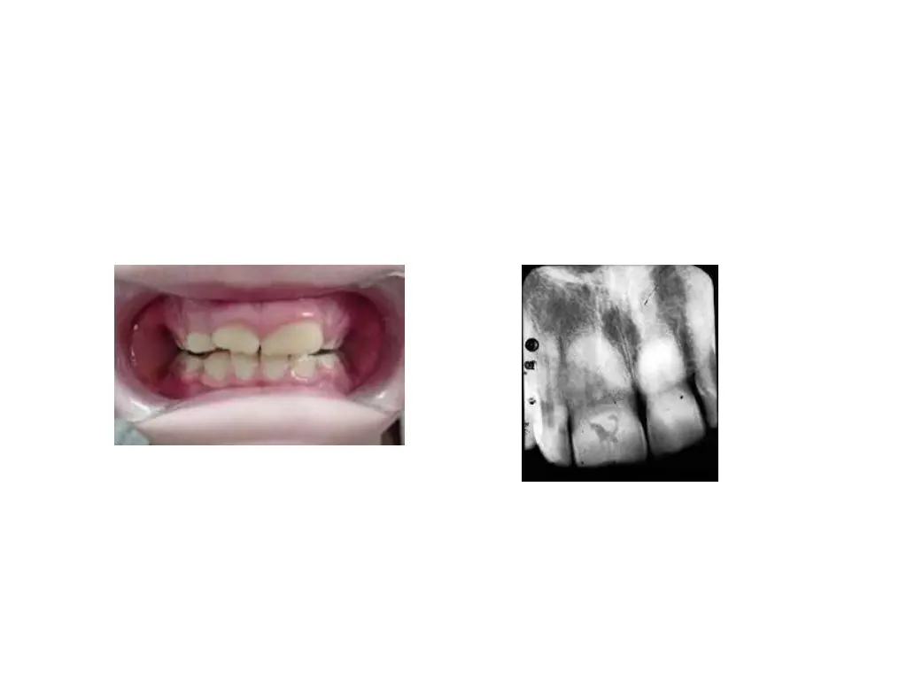 slide8