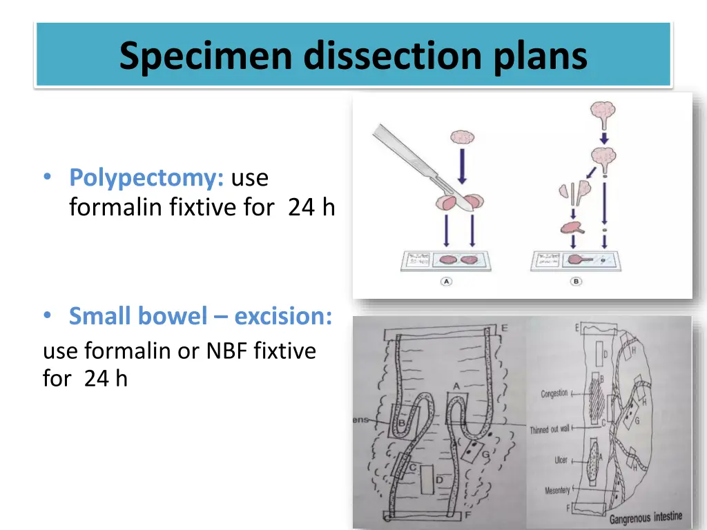 specimen dissection plans 3