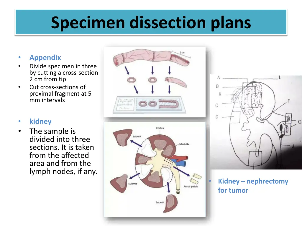 specimen dissection plans 5