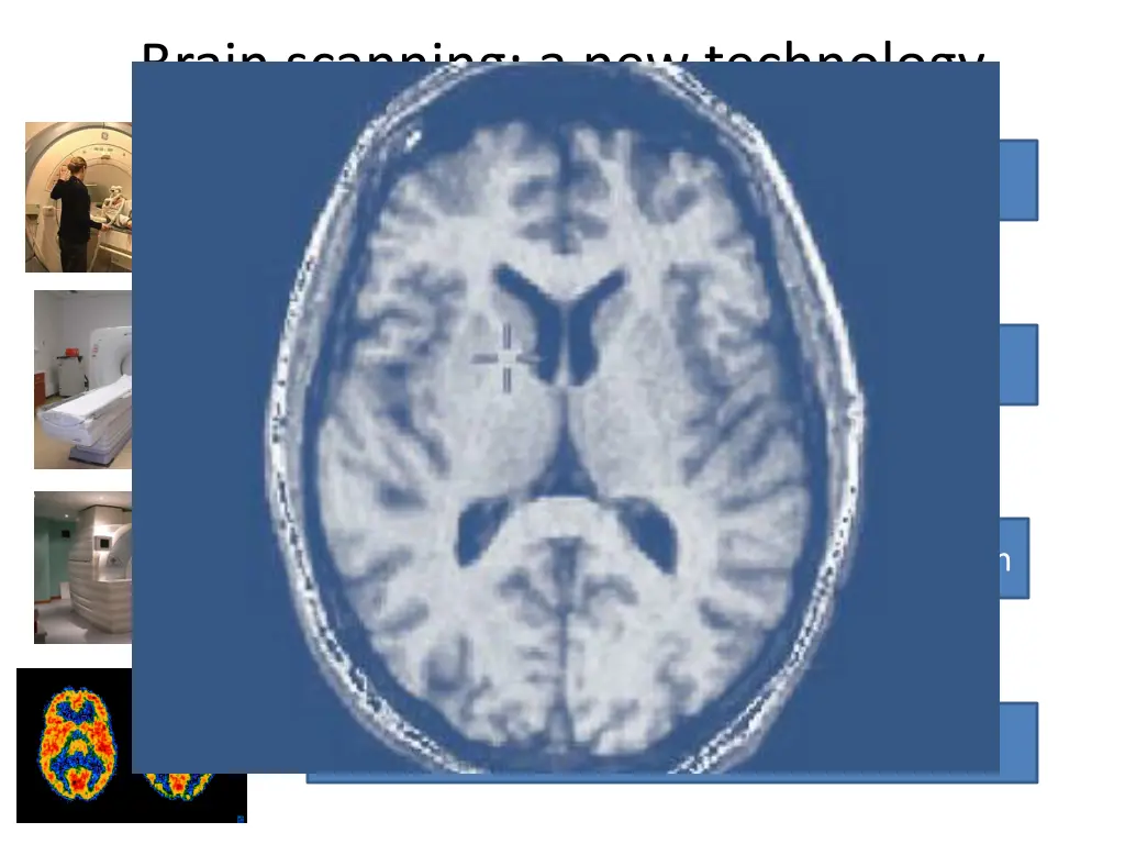 brain scanning a new technology