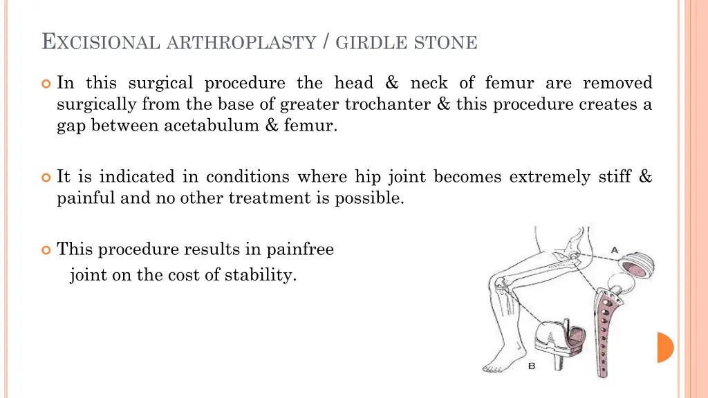 e xcisional arthroplasty girdle stone
