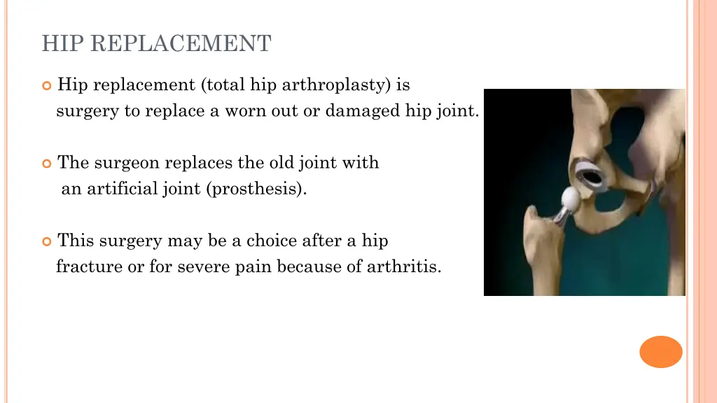 hip replacement