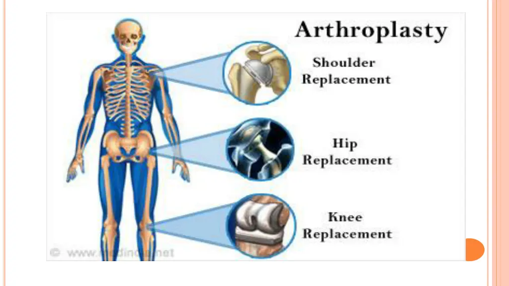 slide3