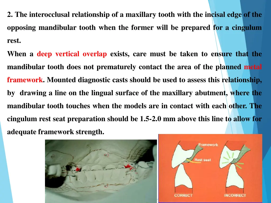 2 the interocclusal relationship of a maxillary