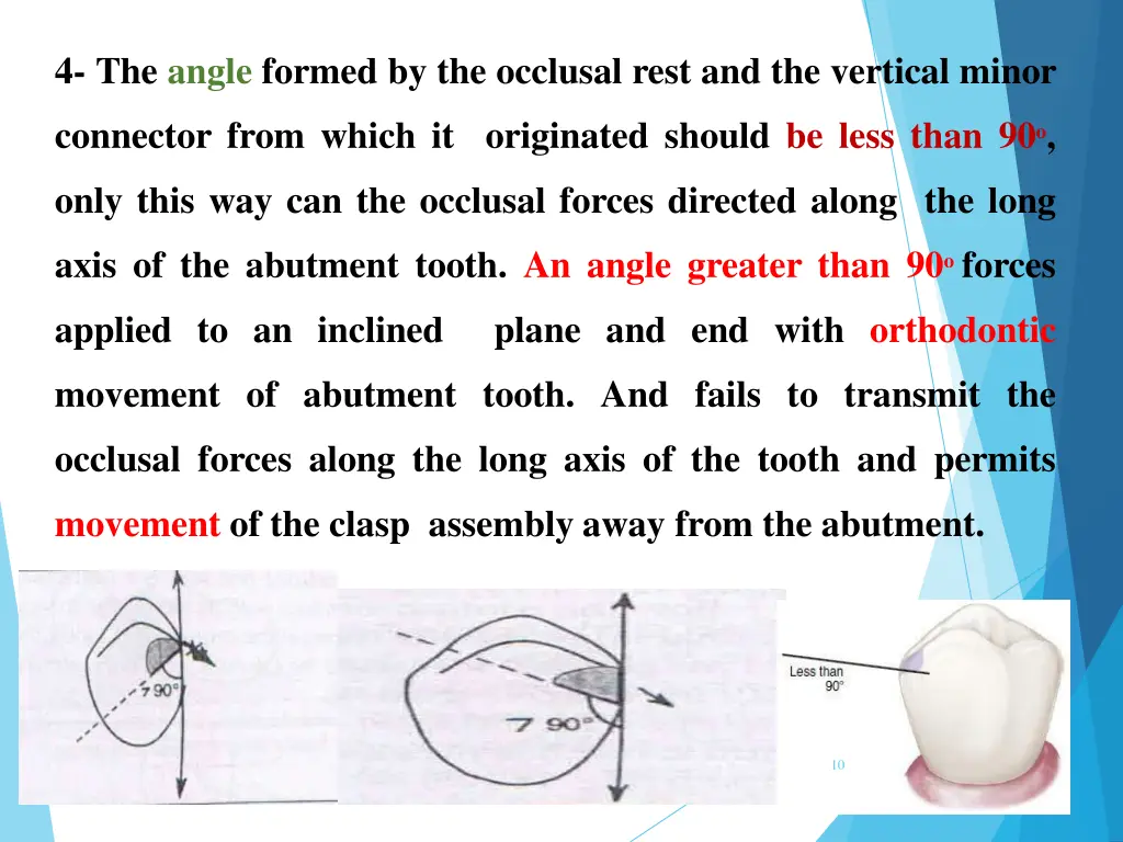 4 the angle formed by the occlusal rest