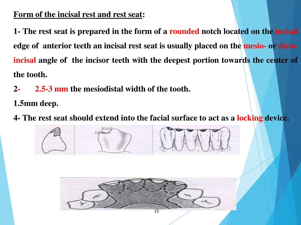 form of the incisal rest and rest seat