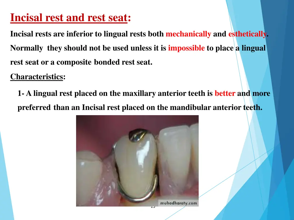 incisal rest and rest seat