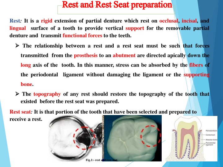 rest restand