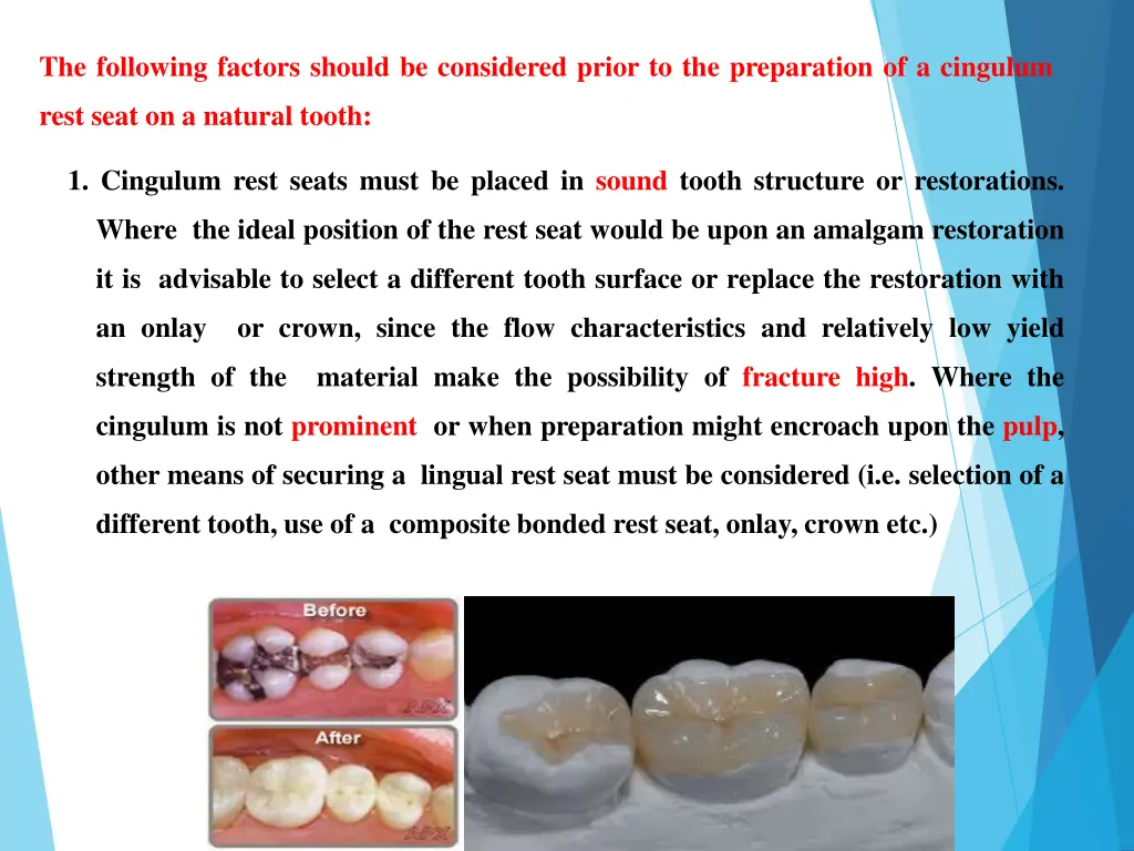 the following factors should be considered prior