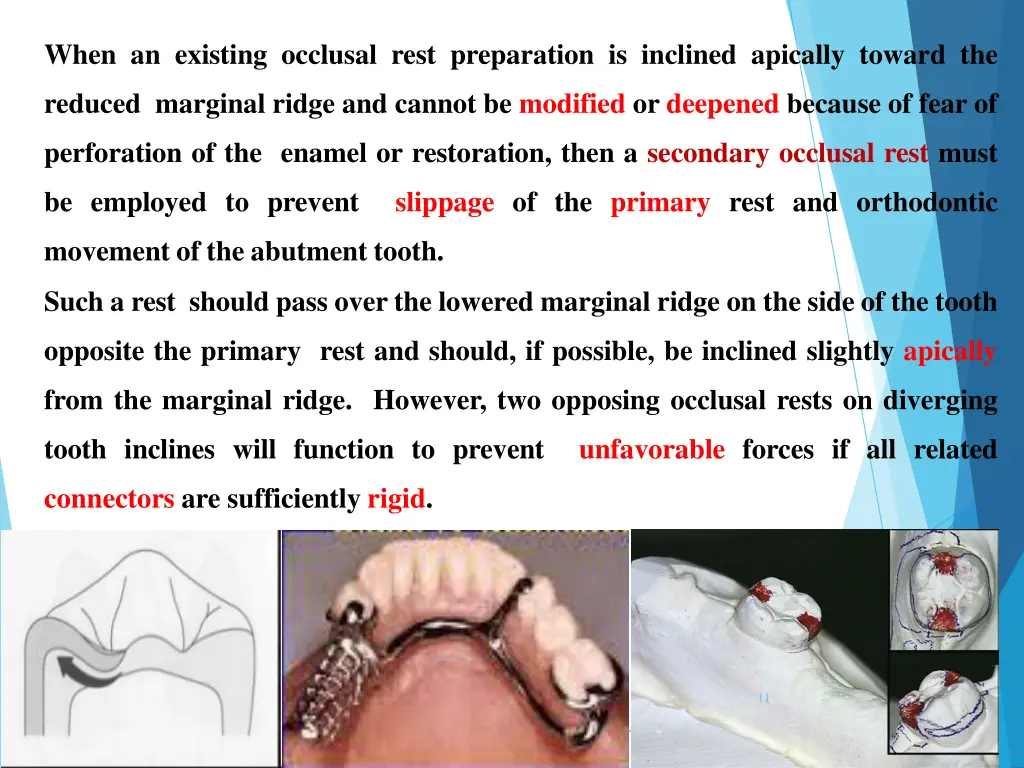 when an existing occlusal rest preparation