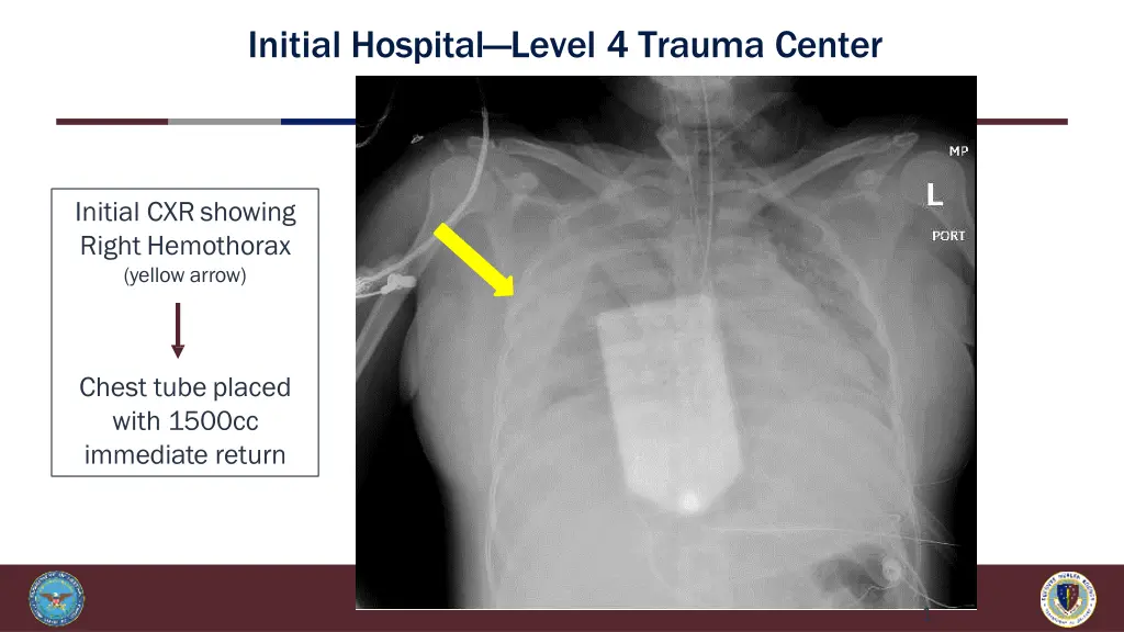initial hospital level 4 trauma center 1