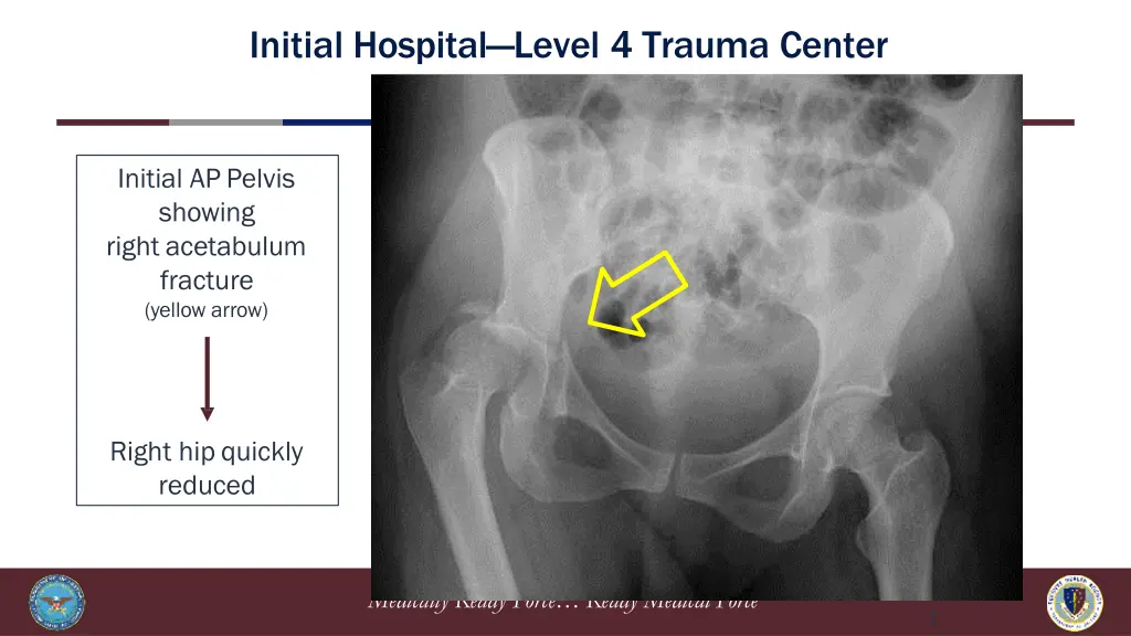 initial hospital level 4 trauma center 2