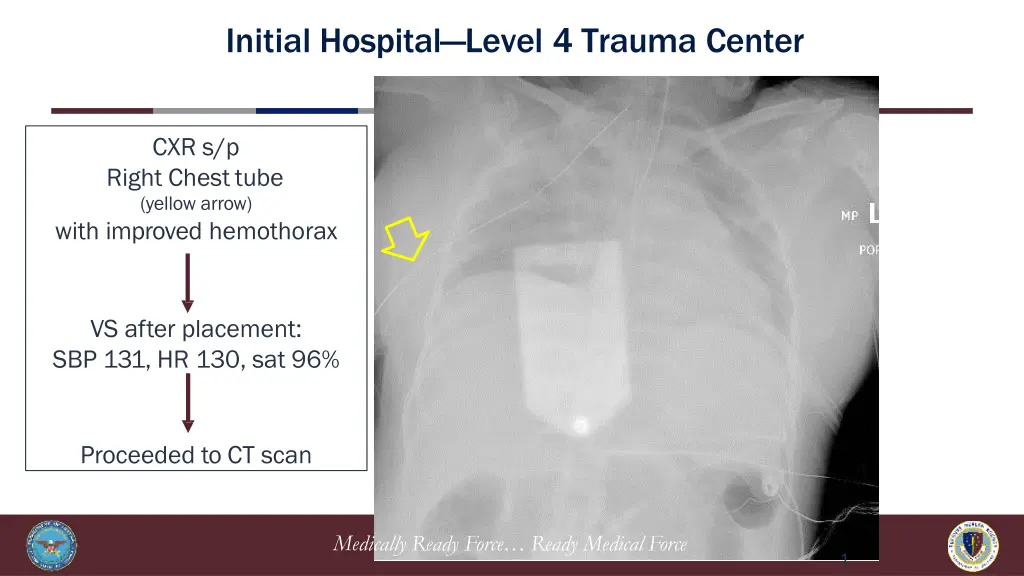 initial hospital level 4 trauma center 3