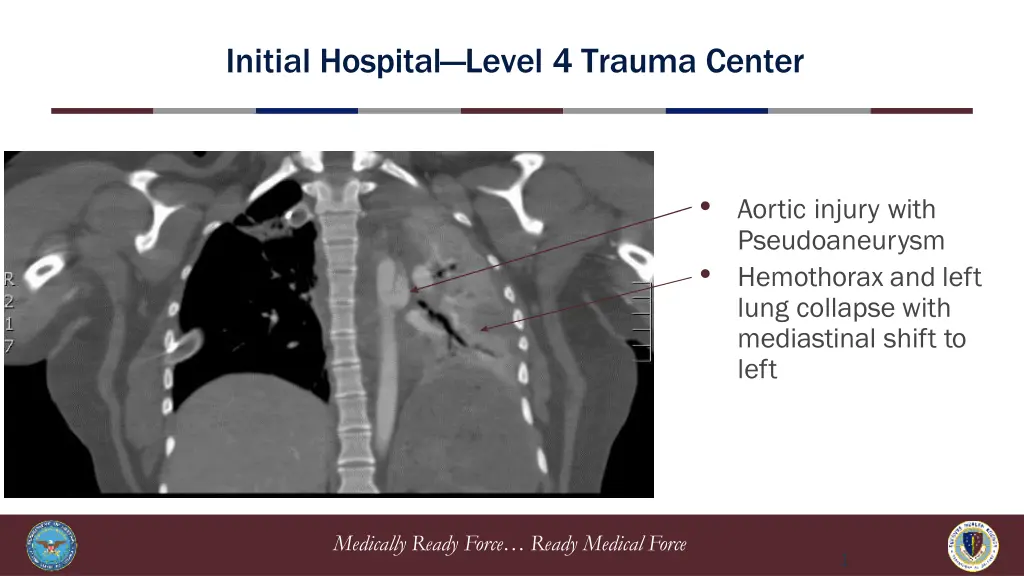 initial hospital level 4 trauma center 5