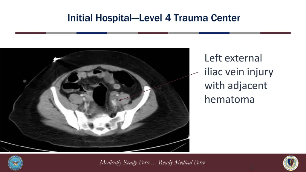 initial hospital level 4 trauma center 6