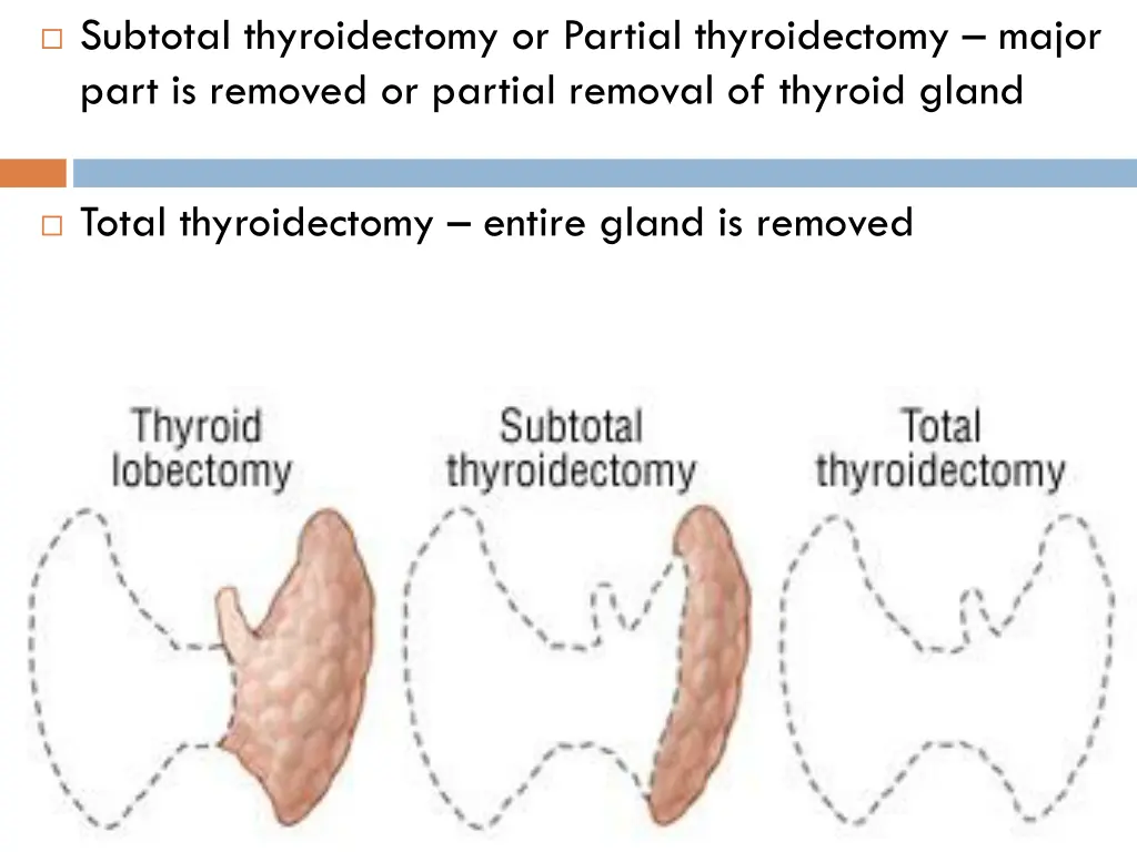subtotal thyroidectomy or partial thyroidectomy