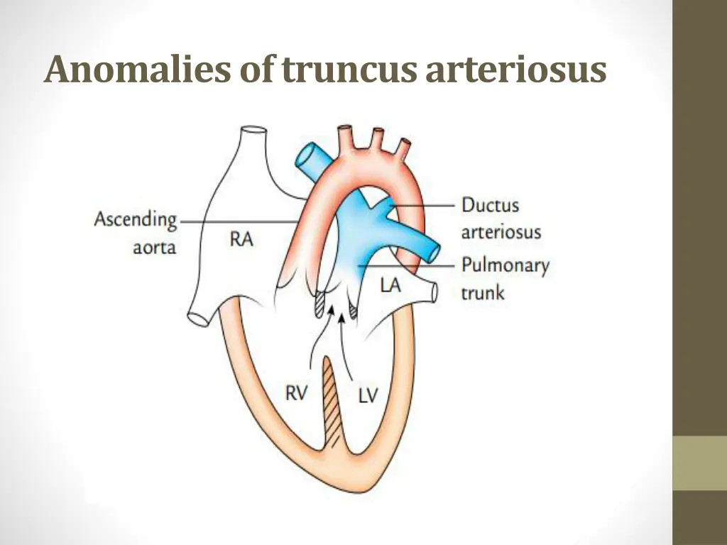 anomalies of truncus arteriosus