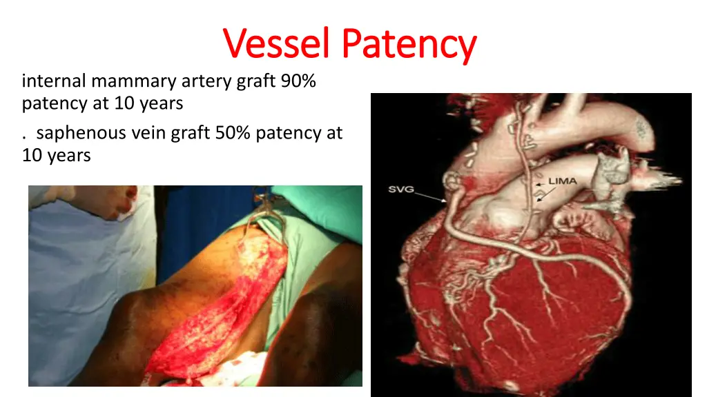 vessel patency vessel patency