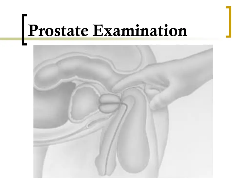 prostate examination