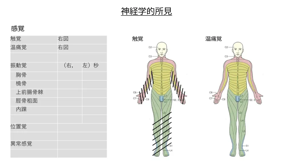 slide7