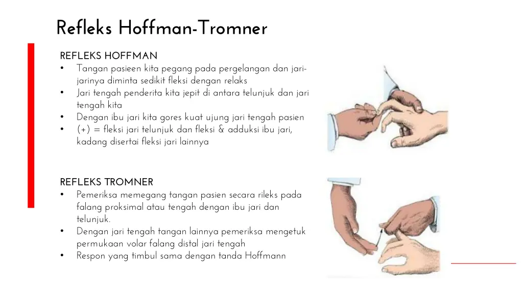 refleks hoffman tromner