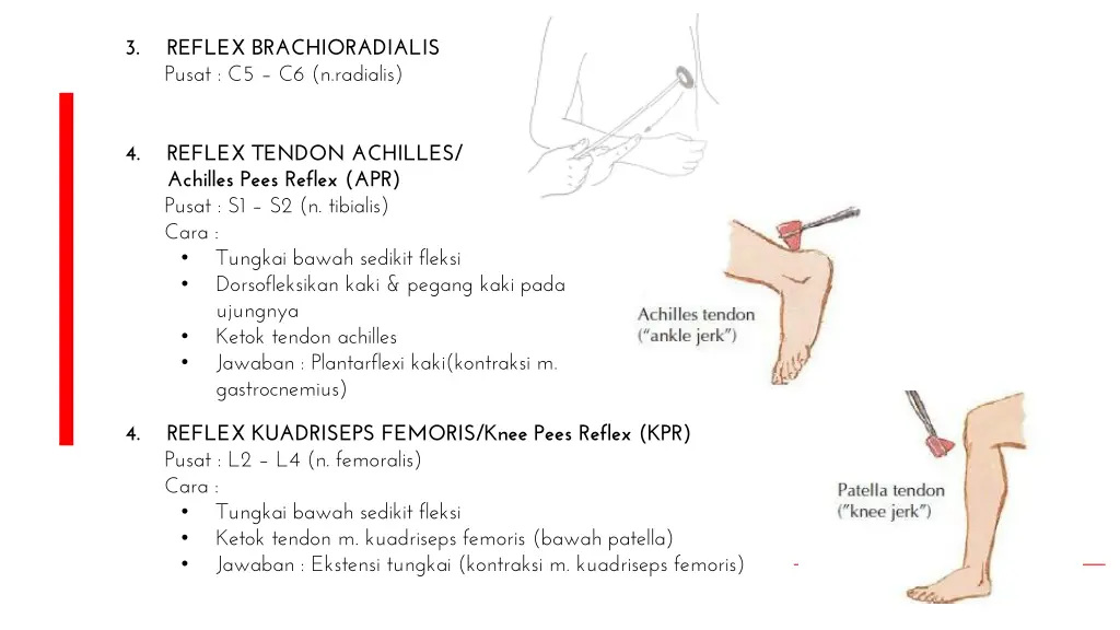 slide28