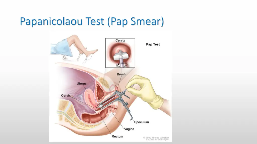 papanicolaou test pap smear