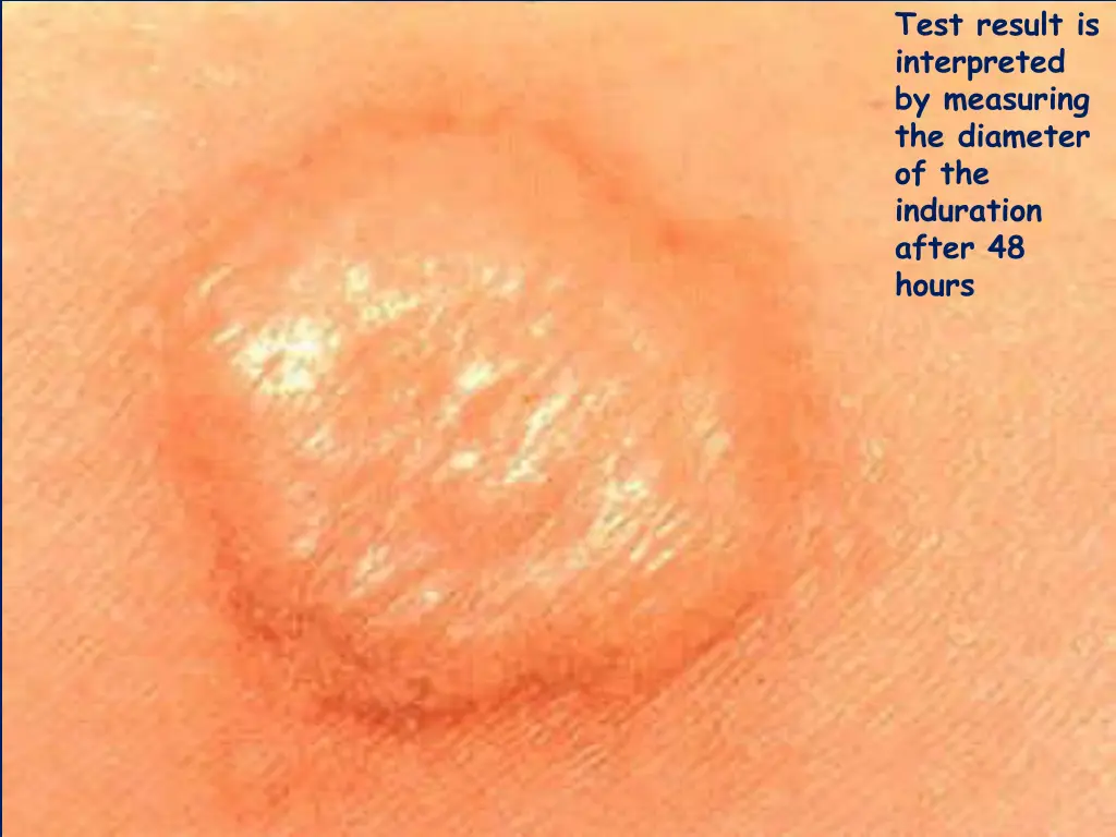 test result is interpreted by measuring