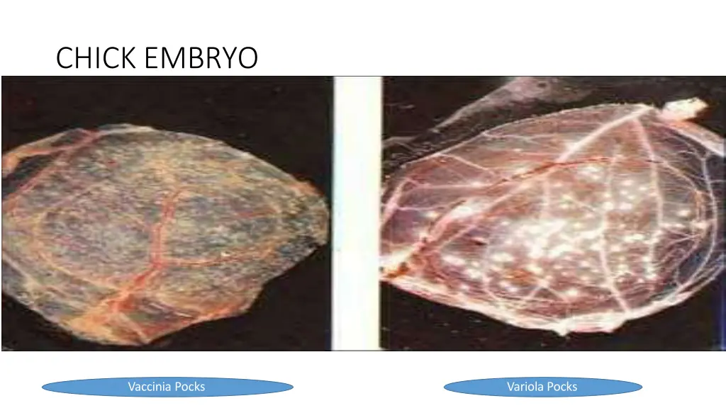 chick embryo