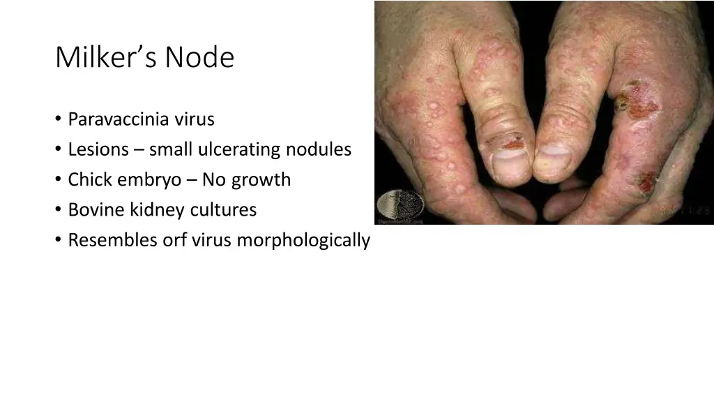 milker s node