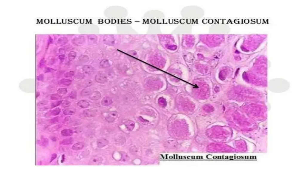 slide27