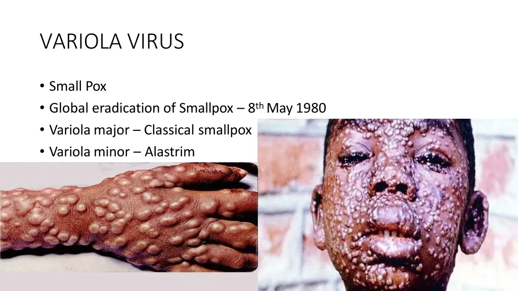 variola virus