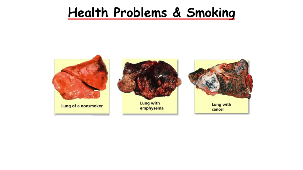smoking and your health