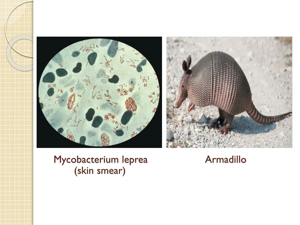 mycobacterium leprea skin smear