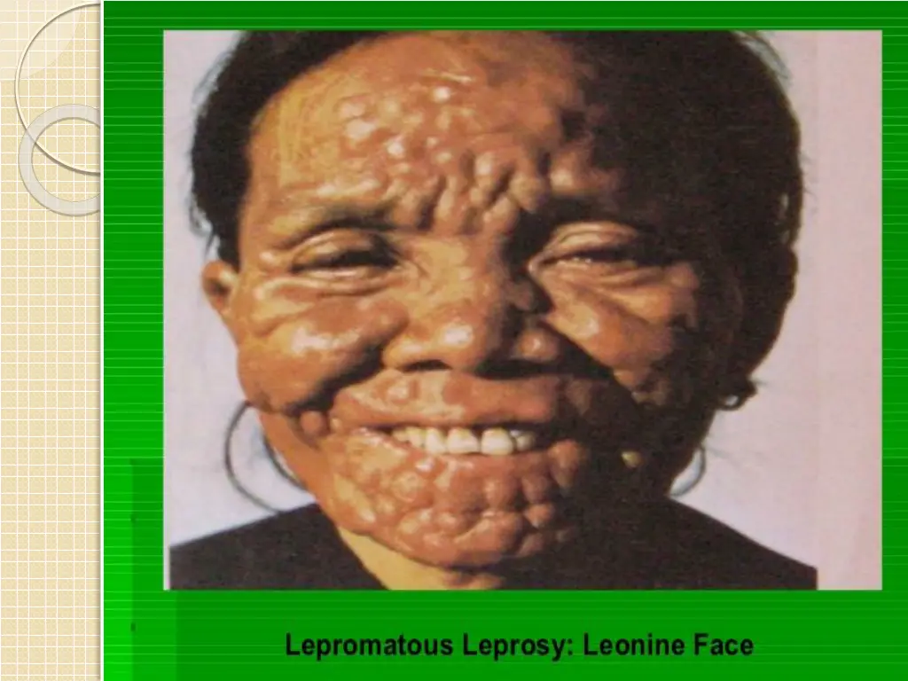 slide19